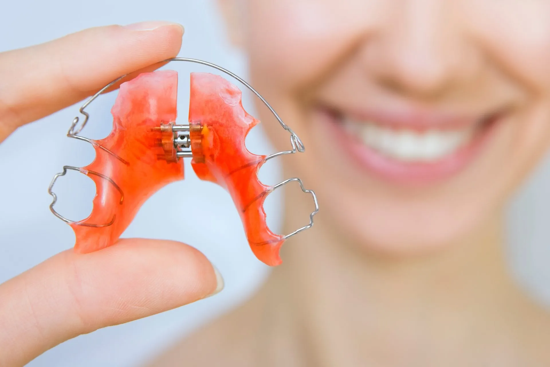 How Ceramic Braces Work to Straighten Your Smile